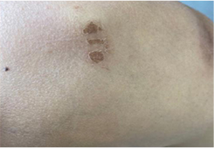 Skin Cover
